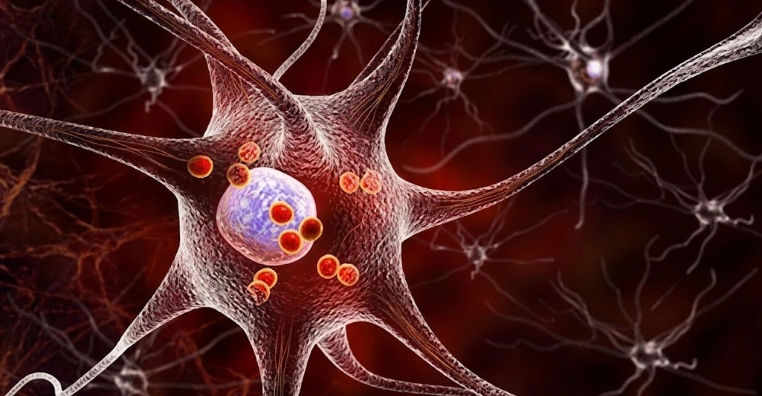 Neurodegenerative Diseases and Gum Disease Inblog